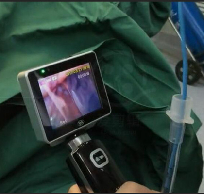 1280 X 720 ক্যামেরা রেজোলিউশন সহ ICU EMS একক ব্যবহার ইনটিউবেশন ভিডিও ল্যারিঙ্গোস্কোপ