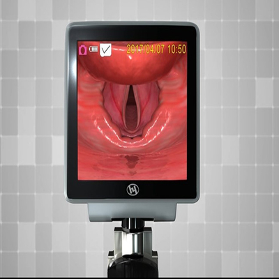 3 ইঞ্চি LCD পোর্টেবল ভিডিও অ্যাসিস্টেড ল্যারিঙ্গোস্কোপ 3400 MA