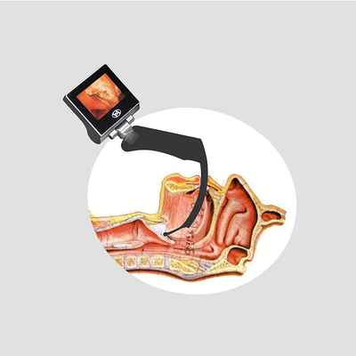 USB 32GB এনেস্থেশিয়া হ্যান্ডহেল্ড ভিডিও ল্যারিঙ্গোস্কোপ HYHJ-KC